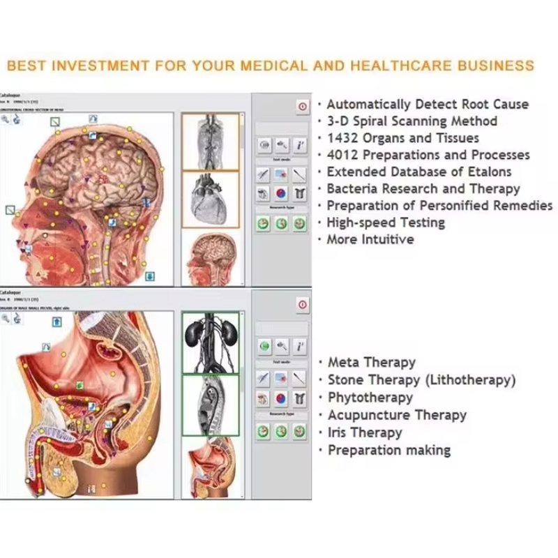Metatron Hunter 4025 NLS Biore - огляд і ціна Holistic Health & Wellness
