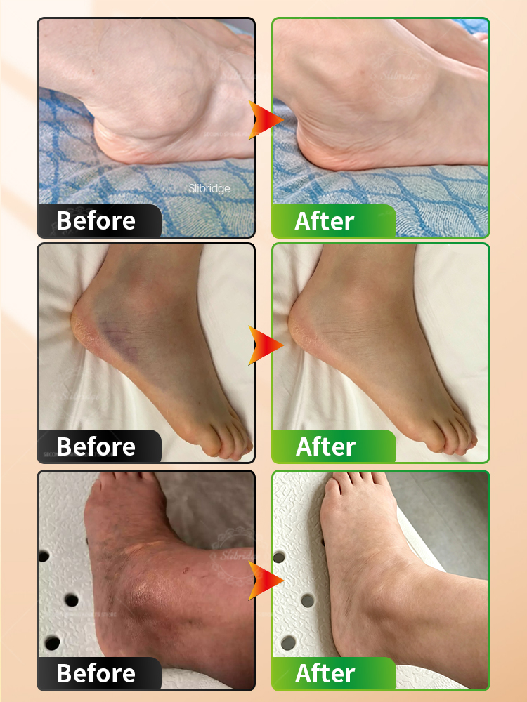 Electric Ankle Massager Heatin - огляд і ціна Ankle Brace Support